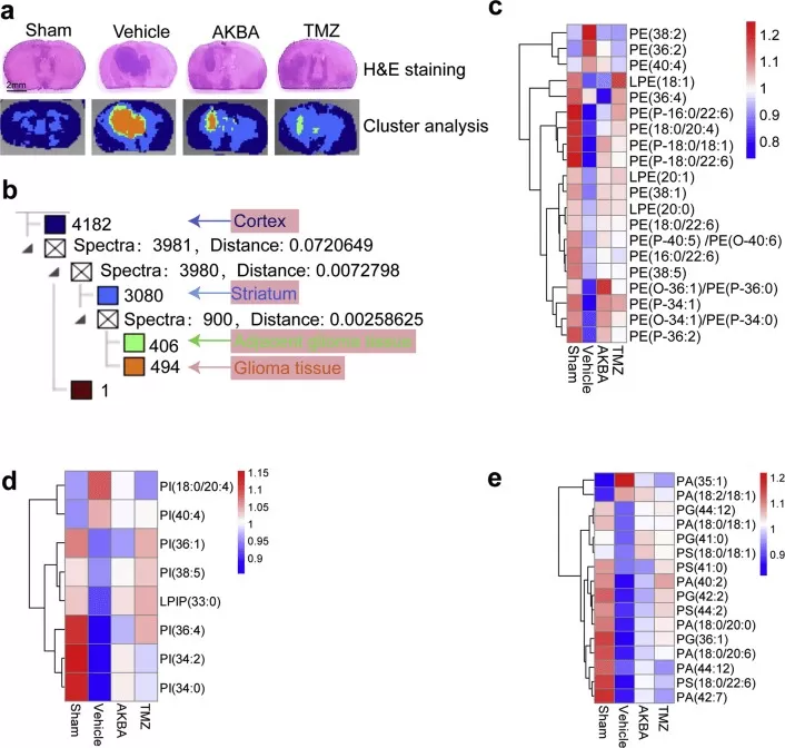 MALDI-MSI of glioma tissues (Li et al., 2020)